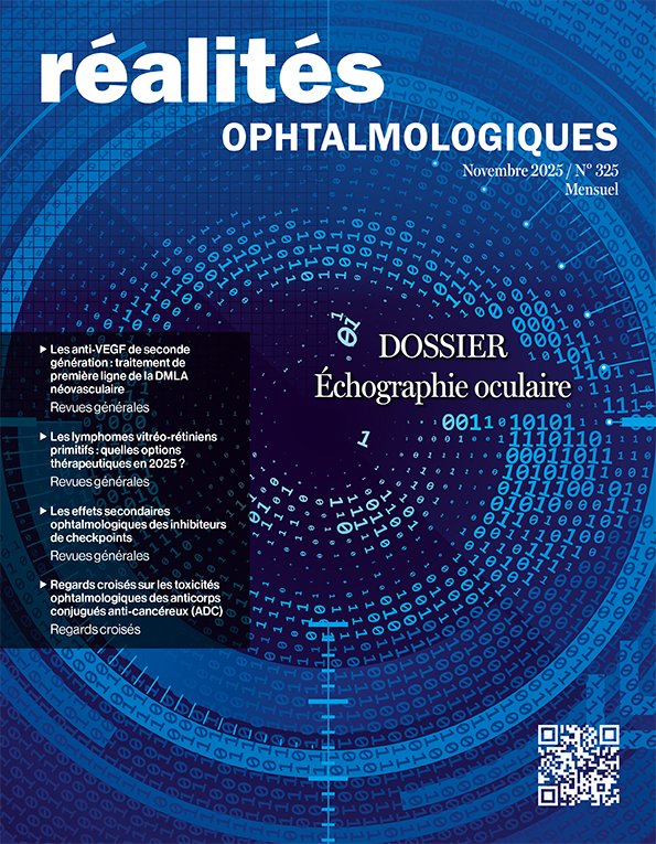L’échographie des tumeurs oculaires (Réalités Ophtalmologiques – n° 325 – Novembre 2025)